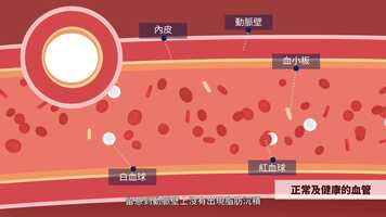 Free download Amgen 控醇行動 disease education video and edit with RedcoolMedia movie maker MovieStudio video editor online and AudioStudio audio editor onlin