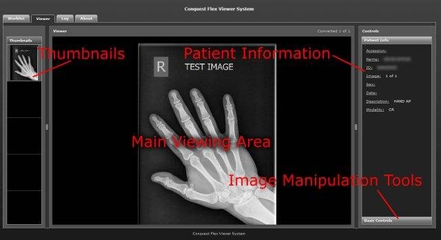 Download web tool or web app Conquest Flex Viewer