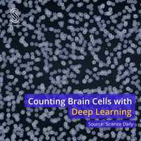 Free download Counting Brain Cells with Deep Learning video and edit with RedcoolMedia movie maker MovieStudio video editor online and AudioStudio audio editor onlin