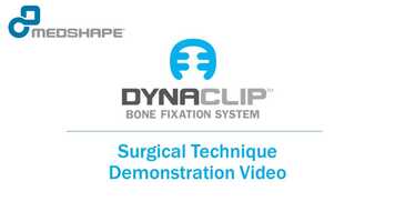 Free download DynaClip Bone Fixation System - Surgical Technique Demonstration video and edit with RedcoolMedia movie maker MovieStudio video editor online and AudioStudio audio editor onlin