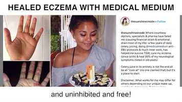 Free download Healed Eczema  Neurological Symptoms With Medical Medium video and edit with RedcoolMedia movie maker MovieStudio video editor online and AudioStudio audio editor onlin