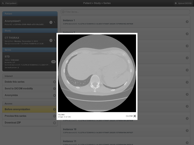 Download web tool or web app Orthanc