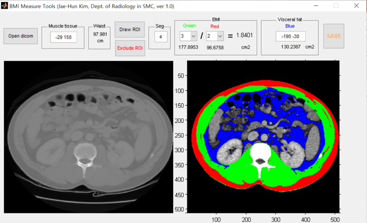 Download web tool or web app Semi-automatic measurement tool (BMI_CT)