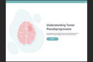 Free download Tumor Pseudoprogression Non-Case Study Learning Module video and edit with RedcoolMedia movie maker MovieStudio video editor online and AudioStudio audio editor onlin