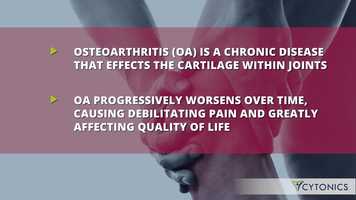 Free download What is Osteoarthritis and Why is it a Problem? video and edit with RedcoolMedia movie maker MovieStudio video editor online and AudioStudio audio editor onlin